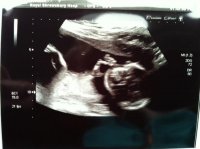 20week1.jpg