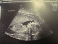 baby.jpg