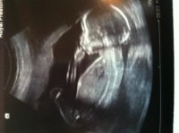 scan 20 wks.jpg