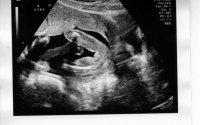 baby A gender.jpg
