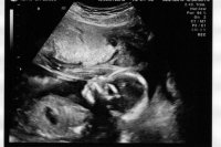 baby B face.jpg