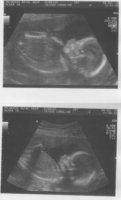 20 wk scan baby 2.jpg