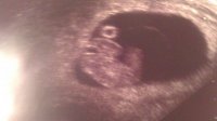 Our baby moo bean 3.jpg