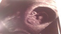 Our baby moo bean 4.jpg