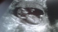 Our baby moo bean 13.jpg