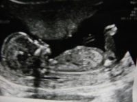 12w5d%2011.jpg