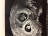 BabyBubbas.jpg