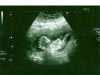 baby2.jpg