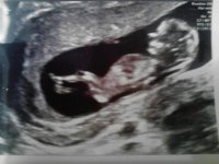 Ultrasound12+2.jpg