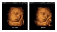 3D Ultrasound.jpg