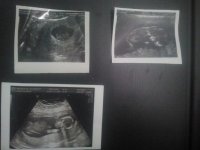 Baby Scans.jpg