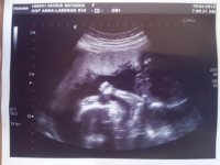 Ultrasound pic!.jpg