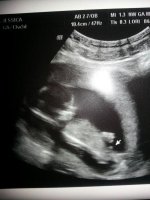 Its a boy.jpg