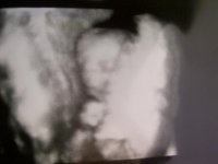 US 16wk 5days.jpg