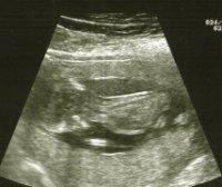 13 week scan small.jpg