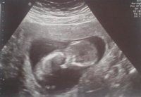12+3 week scan pic (2).jpg