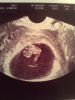 baby 3 at 8.5 weeks.jpg