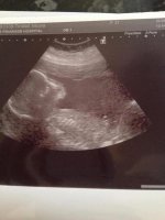 20 week scan.jpg