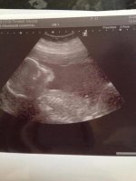 20 week scan.jpg