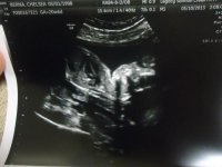 ultrasound1.jpg