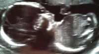 baby scan 20 week1.jpg