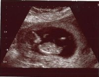 Baby scan 12 weeks.jpg