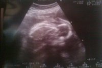 18 weeks.jpg