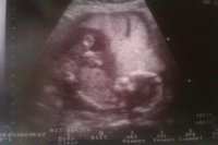 18 weeks 2.jpg