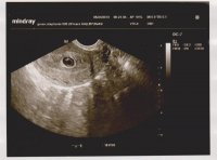 baby 002.jpg