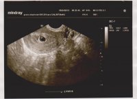 baby 003.jpg