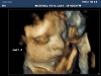 BabyA3D33Weeks.jpg