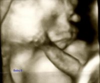 Baby B close up.jpg