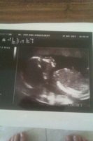 20 weeks 1.jpg