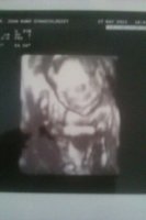 20 weeks 2.jpg