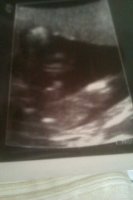 20 weeks 5.jpg