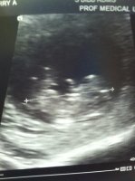 ultrasound 5-28.jpg