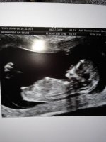 12 Week Scan....jpg