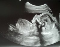baby1a.jpg