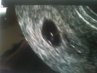 6 Week Squishy!.jpg