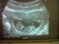 10 Week Old Squishy.jpg