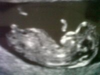 baby scan 04-06-13.jpg