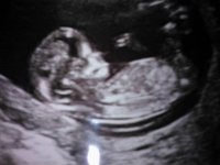 Baby at 12weeks.jpg