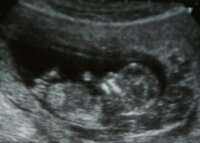 young4.jpg