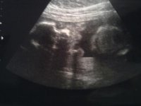 21 weekse.jpg