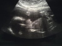 21 weeksc.jpg