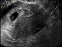 baby.jpg