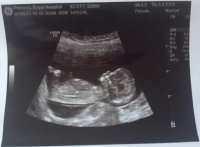 Baby13weeks.jpg