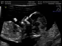 BABY 6-26_2.jpg