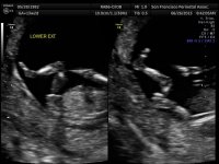 BABY 6-26_6.jpg