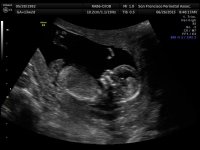 BABY 6-26_8.jpg
